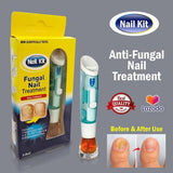 Tretman protiv gljivica na noktima gljivične infekcije nokta - Tretman protiv gljivica na noktima gljivične infekcije nokta