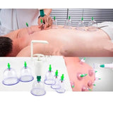 Ventuze Vakum masazer 12kom Set Ventuza za vakum masazu