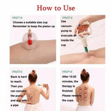 Ventuze Vakum masazer 12kom Set Ventuza za vakum masazu