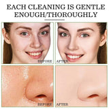 Maska za lice Maska za negu koze Cuvena Zelena maska - Maska za lice Maska za negu koze Cuvena Zelena maska