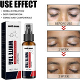 Sprej za lečenje psorijaze