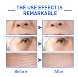 Kolagen Boost esencija protiv starenja