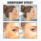 Hidratantna Krema za Uklanjanje Pega