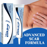 Hranljiva krema za ožiljke