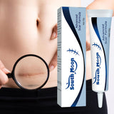 Hranljiva krema za ožiljke