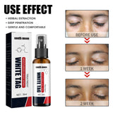 Krema protiv Vitiliga