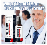 Krema protiv Vitiliga