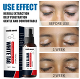 Krema protiv Vitiliga