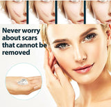 Krema za Uklanjanje Strija i Ožiljaka