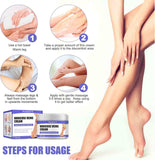 Krema za lečenje proširenih vena