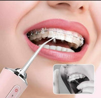 Oralni Irigator - Električni Aparat za Čišćenje Desni i Zuba