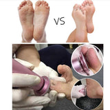 Turpija za stopala elektricna FCM-01 - Turpija za stopala elektricna FCM-01