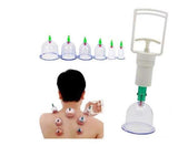 Ventuze za masazu tela - set za vakuumsku masazu - Ventuze za masazu tela - set za vakuumsku masazu