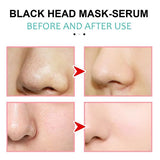 EELHOE Tečna maska za mitisere i akne