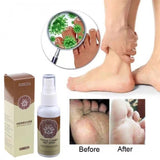 Herbcure – Sprej protiv gljivica i sličnih bolesti stopala