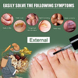 Esencija za uklanjanje gljivica na noktima