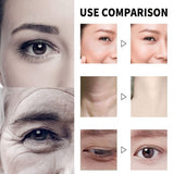 Eelhoe esencijalno ulje sa vitaminom C protiv bora