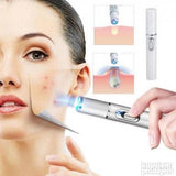 Olovka protiv Akni-Bubuljica